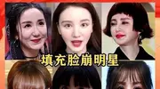 直到曾黎吴越演《沉默的荣耀》，才发现，医美在演技面前不值一提