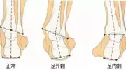 别再乱猜！3分钟带你看清异足类真面目！