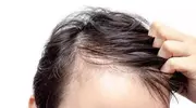 掉发背后隐藏的秘密，你知道吗？