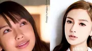 戚薇自曝医美翻车，戳穿娱乐圈整容谎言！