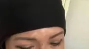 舌癌后回归，张咪用生命歌唱，太震撼！