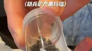 胡兵泰国手术引热议，6小时取出半罐结石，生病原因令人意外
