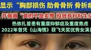 女明星热依扎晒X光片自曝骨折遭群嘲？这波操作揭开娱乐圈遮羞布