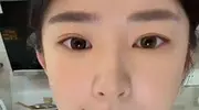 嘉年华开始，拉黑结束，黄一鸣自曝花10万整容，豪门梦醒的太晚了